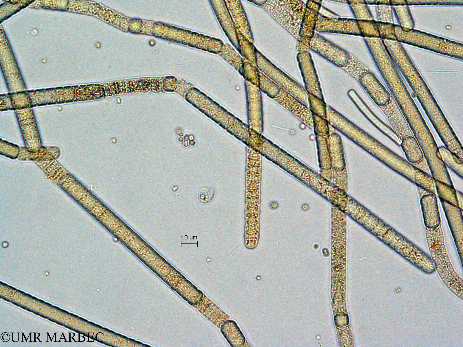 phyto/Mayotte/dziani/DZIANI 2007-2016/Nanoflagellé 4 et Microcoleaceae (ancien et Geitlerinema sp2-ancien Flagelle 1, les 2 cyanos, PICO)(copy).jpg